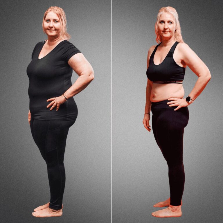 Transformation einer Lipödem-Patientin, die durch gezielte Ernährung und Bewegung mit Körperverwandlung 20 kg abgenommen hat.