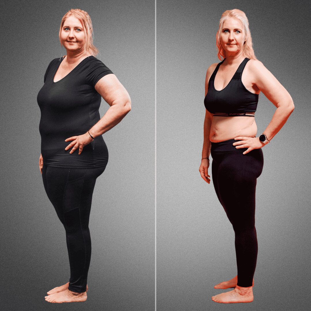 Transformation einer Lipödem-Patientin, die durch gezielte Ernährung und Bewegung mit Körperverwandlung 20 kg abgenommen hat.
