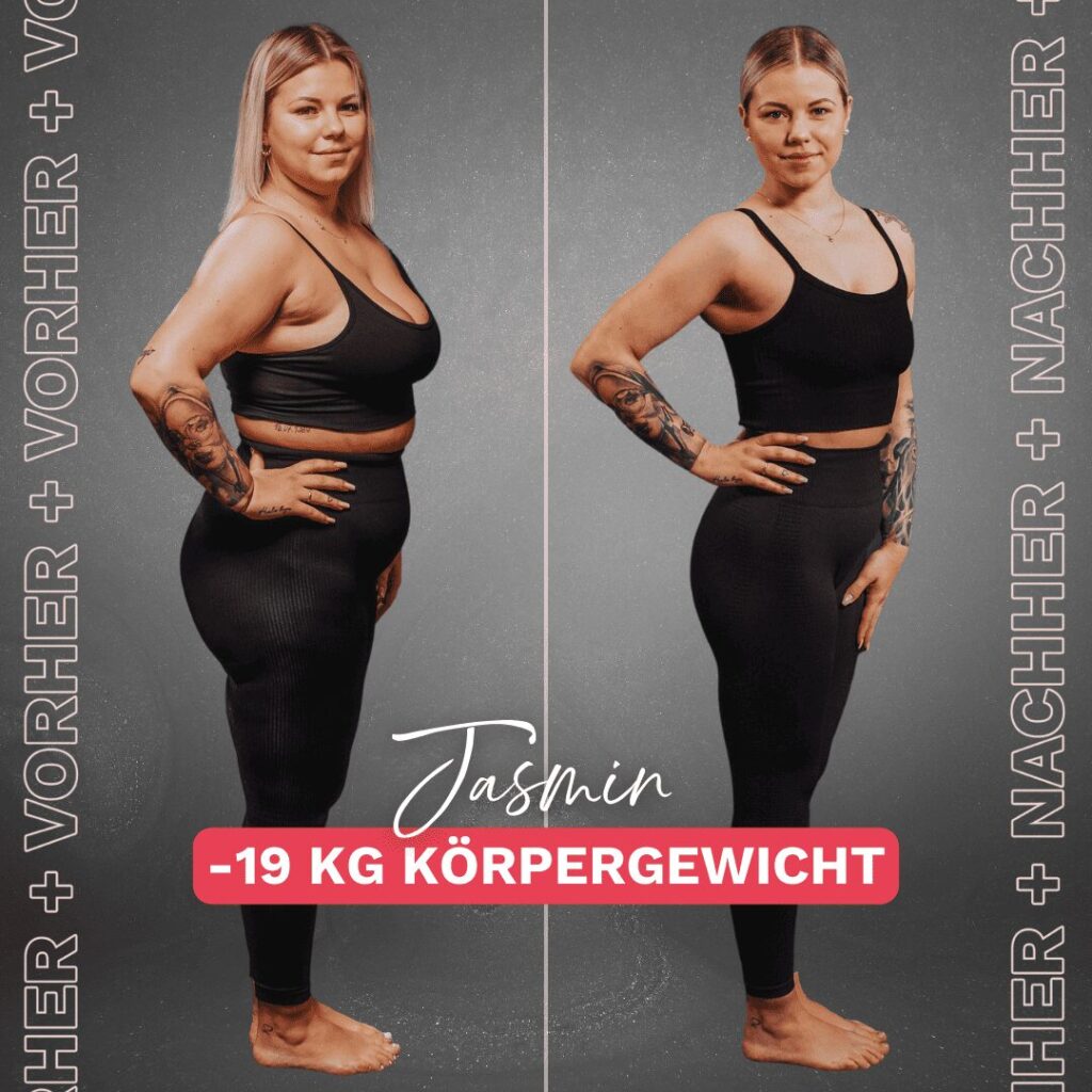 Lipödem-Betroffene vor und nach ihrer Transformation – 19 kg Gewichtsverlust mit Unterstützung der Körperverwandlung.